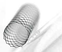 Gastrointestinal Stents 