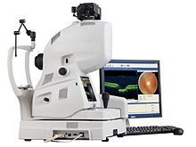 Optical Coherence Tomography Equipment 