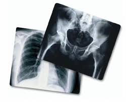 X-ray Film