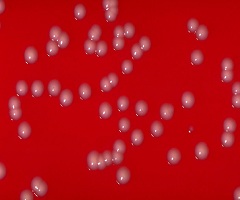 Corynebacterium Parvum