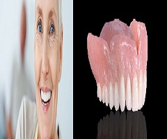 Denture
