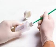 HPV Testing
