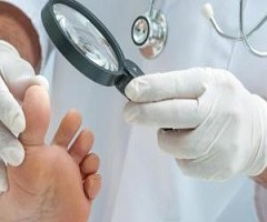 Onychomycosis (Tinea Unguium) Drug