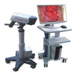 Video Colposcope