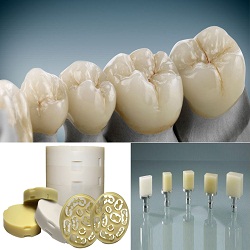 Hybrid-Ceramic Dental CAD/CAM Material Consumption